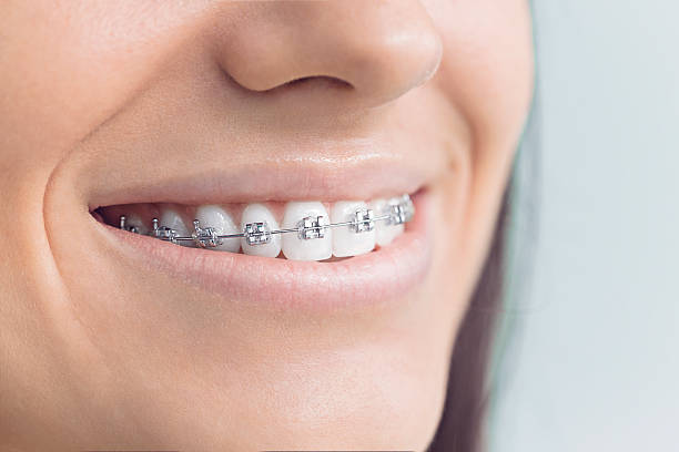 Best Invisalign and Clear Aligners  in Monmouth Junction, NJ